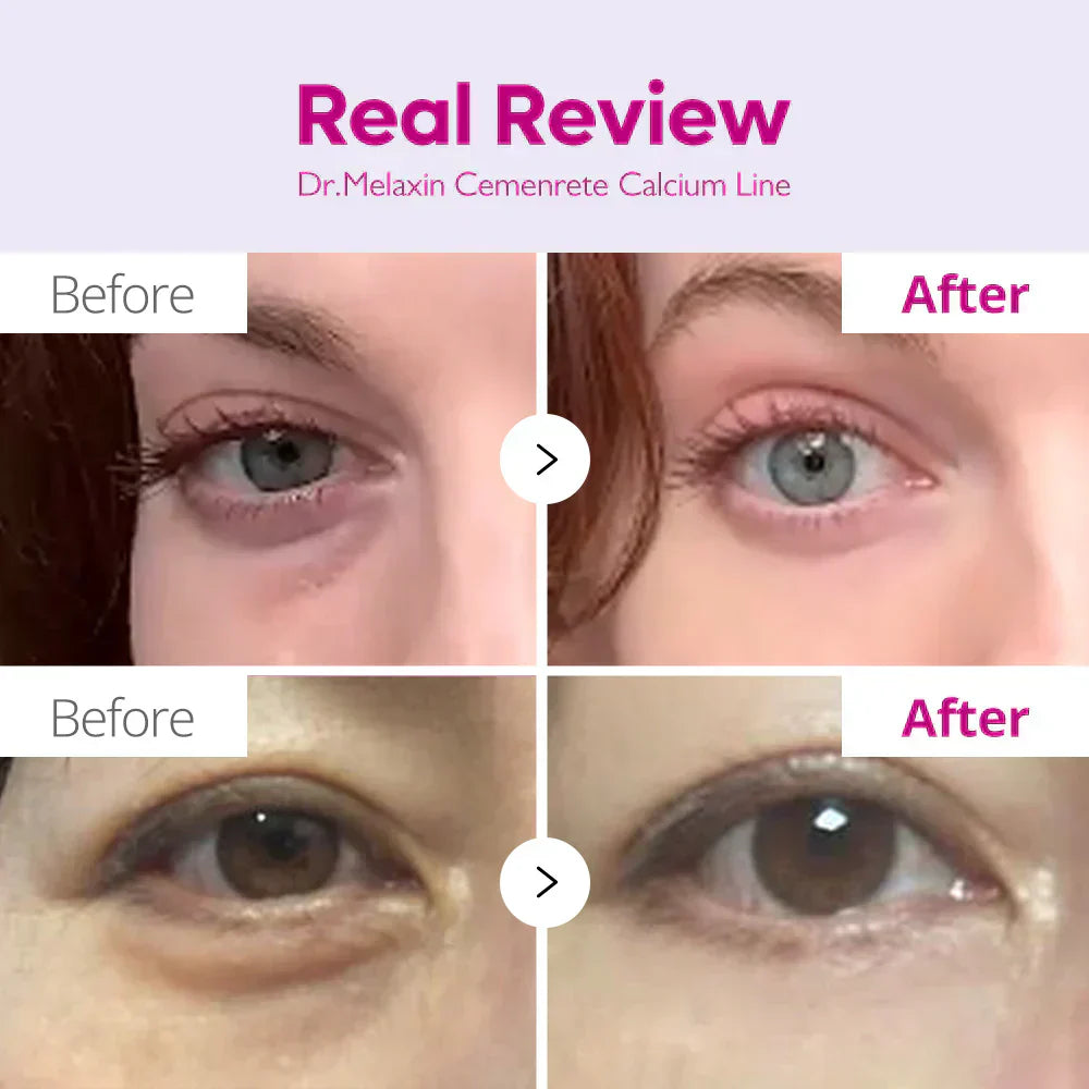 Cemenrete Eye care Line detail view 4 — CoreLab Skin