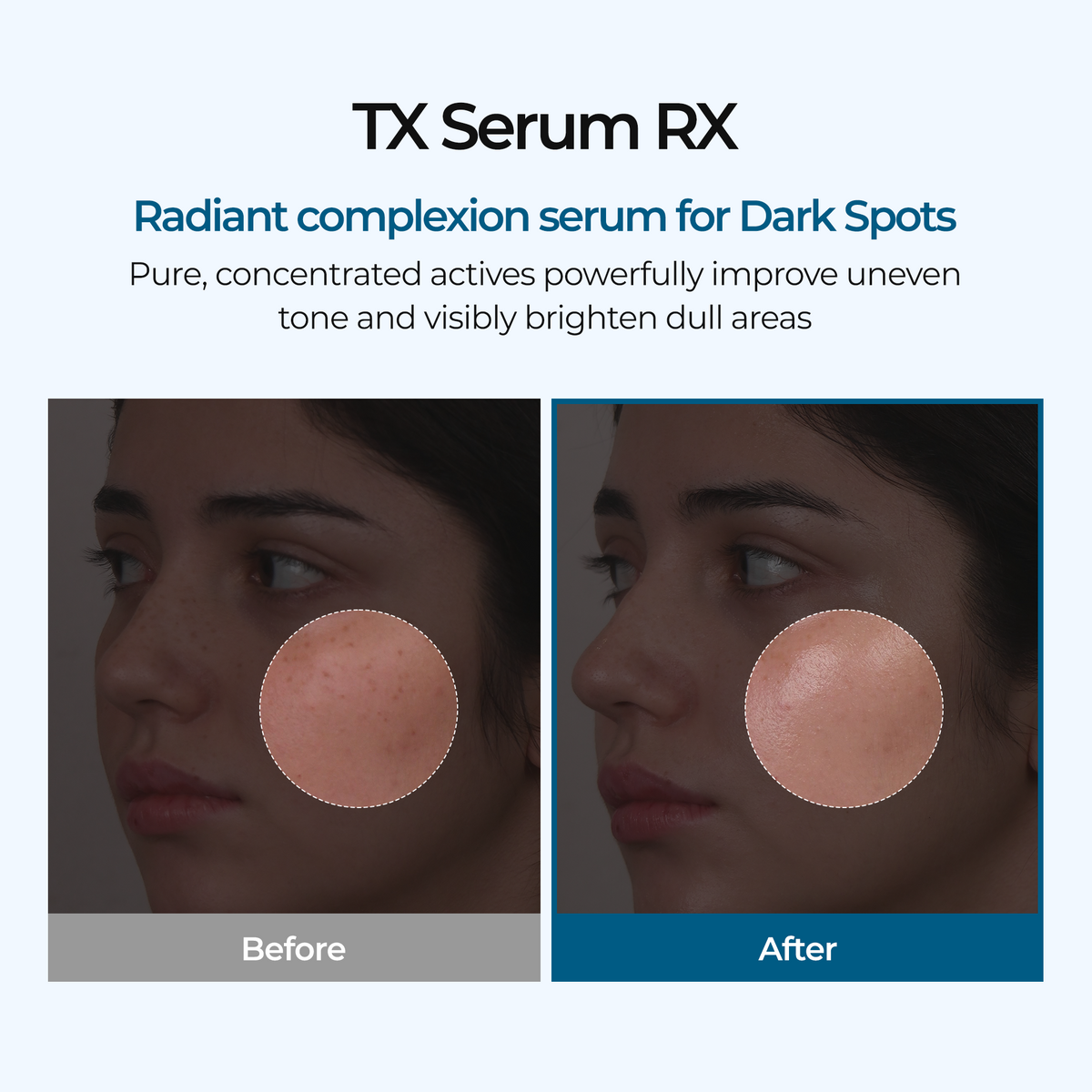 TX Ampoule Rx alternate angle — CoreLab Skin