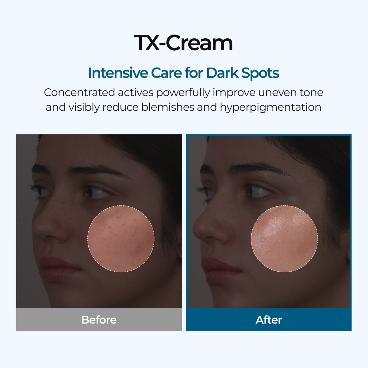 TX Cream detail view 4 — CoreLab Skin