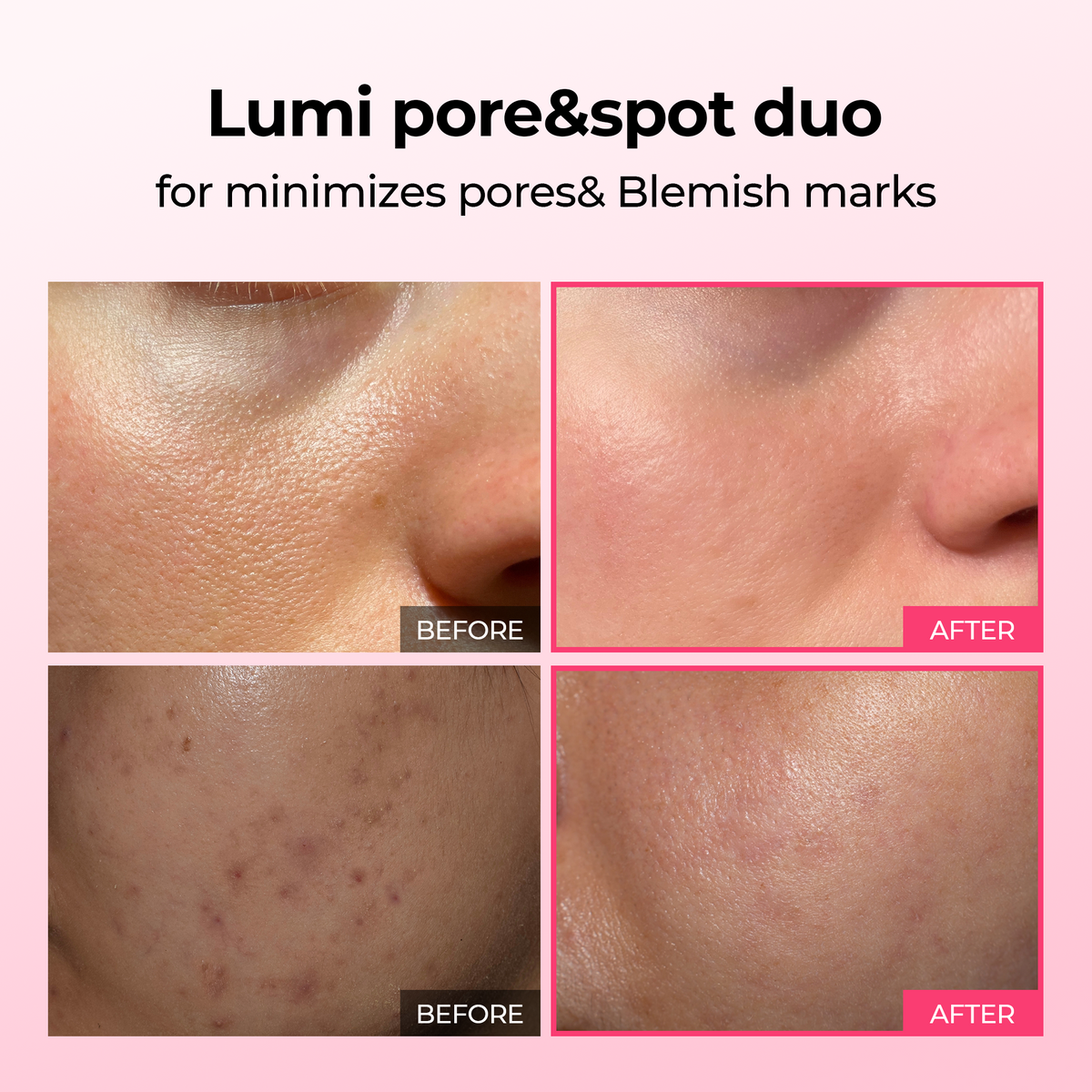 Lumi Pore & Spot Care Duo alternate angle — CoreLab Skin
