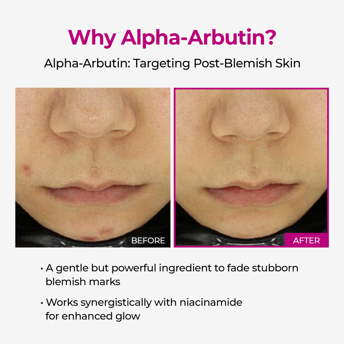 Lumi Pore & Spot Care Duo detail view 8 — CoreLab Skin