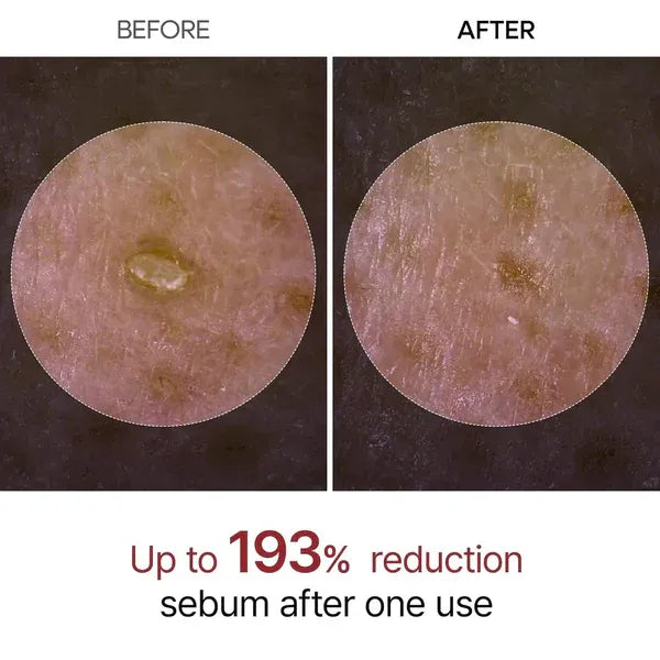 Dr. Melaxin Rice Peel Ampoule before and after result — CoreLab Skin